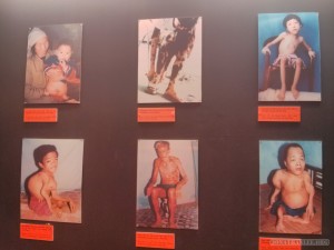 Saigon - War Remnants Museum agent orange victims 1